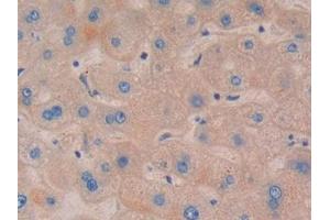 DAB staining on IHC-P; Samples: Human Liver Tissue (NOD1 Antikörper  (AA 612-826))