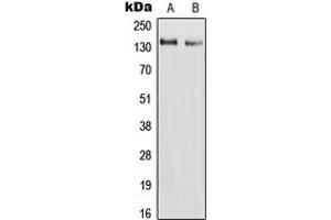 Western blot analysis of RAPH1 expression in HepG2 (A), H9C2 (B) whole cell lysates. (RAPH1 Antikörper  (Center))