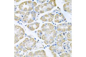 Immunohistochemistry of paraffin-embedded human stomach using TNFRSF10A antibody (ABIN5973697) at dilution of 1/100 (40x lens). (TNFRSF10A Antikörper)