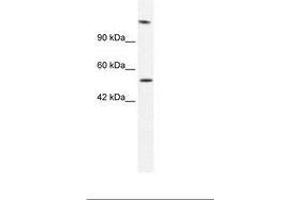 Image no. 1 for anti-DNA Helicase B (HELB) (AA 77-126) antibody (ABIN202971)