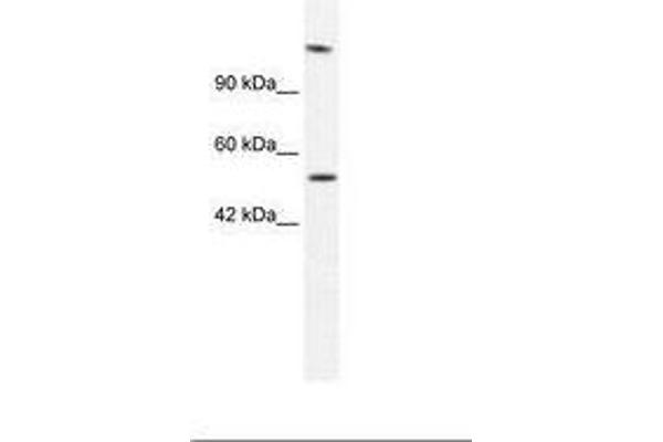 DNA Helicase B 抗体  (AA 77-126)