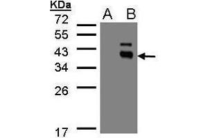 WB Image Western Blot analysis of PPM1K expression in transfected 293T cell line by PPM1K polyclonal antibody.