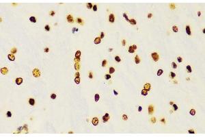 Immunohistochemistry of paraffin-embedded Rat brain using DiMethyl-Histone H3-K4 Polyclonal Antibody at dilution of 1:100 (40x lens).