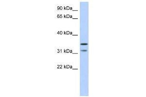 Western Blotting (WB) image for anti-Retinoic Acid Induced 12 (RAI12) antibody (ABIN2459706) (Retinoic Acid Induced 12 (RAI12) Antikörper)