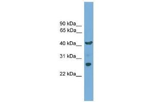 TMEM176A antibody used at 0. (TMEM176A Antikörper  (N-Term))