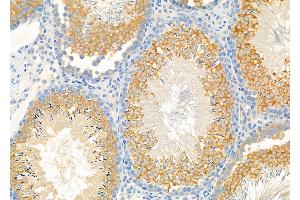 ABIN6261300 and ABIN6273226 at 1/100 staining Rat testis tissue by IHC-P.