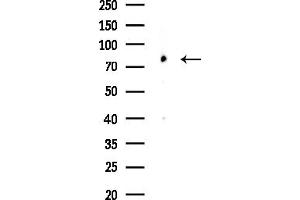 Western blot analysis of lysates from COLO205 cells, using Phospho- (Ser726) Antibody at 1/1000 dilution.