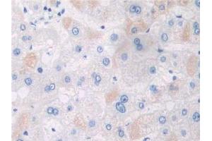 Immunohistochemistry (IHC) image for anti-Adaptor Protein, phosphotyrosine Interaction, PH Domain and Leucine Zipper Containing 1 (APPL1) (AA 404-673) antibody (ABIN5013082)
