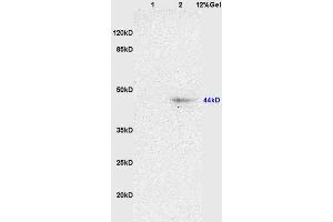 L1 rat brain lysates L2 rat heart lysates probed with Anti NK-2R/Neurokinin A Polyclonal Antibody, Unconjugated (ABIN725315) at 1:200 overnight at 4 °C. (TACR2 Antikörper  (AA 223-300))