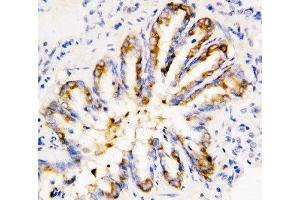 IHC-P: Calpain 1 antibody testing of rat lung tissue (CAPN1 Antikörper  (Middle Region))