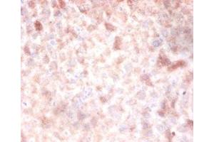 Immunohistochemistry of paraffin-embedded mouse liver tissue using ABIN7150112 at dilution of 1:100 (DNMT3A Antikörper  (AA 680-902))