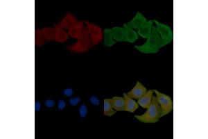 anti-EPH Receptor A2/3/4 (EPHA2/3/4) (pTyr588), (pTyr596) antibody