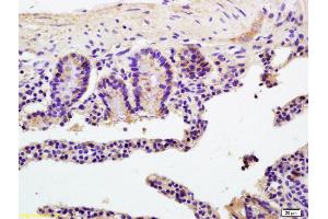 Formalin-fixed and paraffin embedded mouse colon labeled with Anti- ATP1b2/Na+K+ATPase Polyclonal Antibody, Unconjugated (ABIN738426) at 1:200 followed by conjugation to the secondary antibody and DAB staining