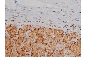 Immunohistochemistry (IHC) image for anti-Insulin-Like Growth Factor 1 Receptor (IGF1R) (pTyr1346) antibody (ABIN6256637)