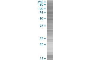 TANK transfected lysate. (TANK 293T Cell Transient Overexpression Lysate(Denatured))