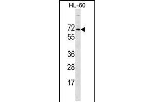 Western blot analysis in HL-60 cell line lysates (35ug/lane). (ACPL2 Antikörper  (AA 306-335))