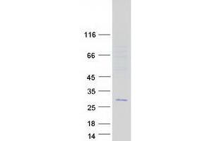 Validation with Western Blot (C11ORF88 Protein (Transcript Variant 1) (Myc-DYKDDDDK Tag))