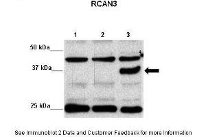 transfected HEK293 (RCAN3 Antikörper  (Middle Region))