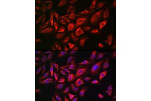 Immunofluorescence (IF) image for anti-Trans-Golgi Network Protein 2 (TGOLN2) antibody (ABIN7270876)