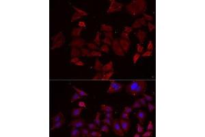 Immunofluorescence analysis of MCF7 cells using NPHP1 Polyclonal Antibody (NPHP1 Antikörper)