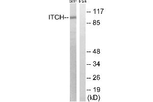 Western blot analysis of extracts from mouse brain cells, using ITCH (Ab-420) antibody. (ITCH Antikörper  (Tyr420))
