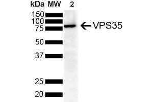 Western Blot analysis of Human SH-SY5Y showing detection of VPS35 protein using Mouse Anti-VPS35 Monoclonal Antibody, Clone 8A3 (ABIN6932977). (VPS35 Antikörper  (PerCP))