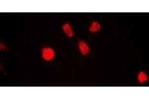 Immunofluorescent analysis of ING5 staining in A549 cells.