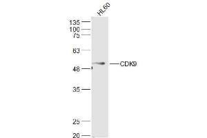 Human HL-60 lysates probed with CDK9 Polyclonal Antibody, Unconjugated  at 1:500 dilution and 4˚C overnight incubation. (CDK9 Antikörper  (AA 231-372))