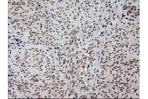 Immunohistochemical staining of paraffin-embedded kidney using anti-HES1 (ABIN2452569) mouse monoclonal antibody. (HES1 Antikörper  (AA 1-280))