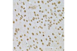 Immunohistochemistry (Paraffin-embedded Sections) (IHC (p)) image for anti-Integrin-Linked Kinase (ILK) (AA 1-260) antibody (ABIN3021145)