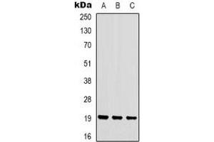 Western blot analysis of STMN1 (pS16) expression in HEK293T (A), Hela (B), Jurkat (C) whole cell lysates. (Stathmin 1 Antikörper  (N-Term, pSer16))