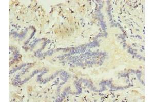 Immunohistochemistry of paraffin-embedded human lung tissue using ABIN7168256 at dilution of 1:100