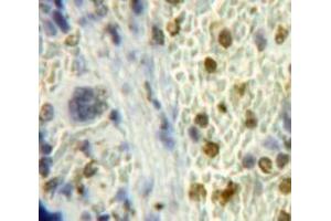 #VALUE! (Inhibitory Subunit of NF-KappaB zeta (AA 414-654) Antikörper)
