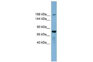 DAPK1 antibody used at 1 ug/ml to detect target protein. (DAP Kinase 1 Antikörper  (N-Term))
