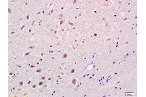 Formalin-fixed and paraffin embedded rat brain labeled with Rabbit Anti phospho-Bim(Ser87) Polyclonal Antibody, Unconjugated (ABIN682873) at 1:200 followed by conjugation to the secondary antibody and DAB staining (BIM Antikörper  (pSer87))