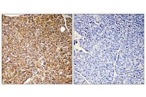 Immunohistochemistry (IHC) image for anti-Phosphoinositide-3-Kinase, Catalytic, gamma Polypeptide (PIK3CG) (Internal Region) antibody (ABIN1852676) (PIK3 gamma Antikörper  (Internal Region))