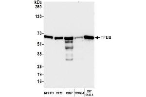 anti-Transcription Factor EB (TFEB) (AA 426-476) antibody