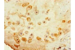 Immunohistochemistry of paraffin-embedded human placenta tissue using ABIN7171850 at dilution of 1:100 (Tetraspanin 14 Antikörper  (AA 114-215))