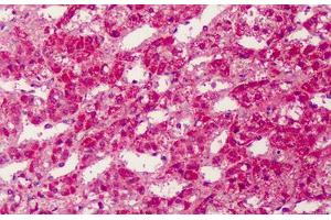 Human Adrenal: Formalin-Fixed, Paraffin-Embedded (FFPE) (PPARG Antikörper  (Internal Region))