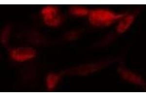 ABIN6278347 staining  MDA-MB-435 cells by IF/ICC. (SENP2 Antikörper)