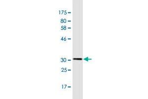 Western Blot detection against Immunogen (32. (TRPC1 Antikörper  (AA 442-505))