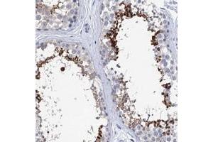 Immunohistochemical staining of human testis with SPATA7 polyclonal antibody  shows strong cytoplasmic positivity in a subset of cells in seminiferous tubules. (SPATA7 Antikörper)