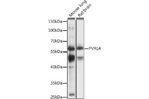 Western blot analysis of extracts of various cell lines, using PVRL4 antibody (ABIN7269433) at 1:1000 dilution. (PVRL4 Antikörper  (AA 371-510))