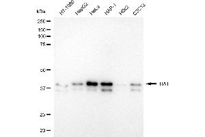 Western blotting analysis using TIA1 antibody (ABIN7800557). (Rekombinanter TIA1 Antikörper)