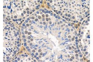 ABIN6260374 and ABIN6279100 at 1/100 staining Mouse testis tissue by IHC-P.