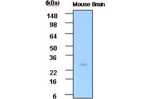 Western blot analysis: Cell lysates of Mouse brain(30ug) were resolved by SDS-PAGE, transferred to PVDF membrane and probed with anti-human PSP (1:1000). (STXBP3 Antikörper)
