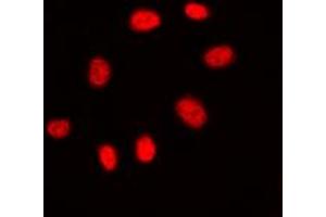 Immunofluorescent analysis of CDC25C staining in A431 cells.