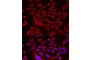 Immunofluorescence analysis of MCF7 cells using TUFM Polyclonal Antibody (TUFM Antikörper)