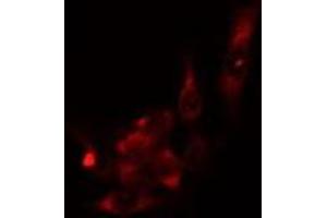 ABIN6276817 staining  HuvEc cells by IF/ICC.