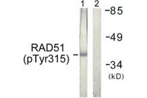 Western blot analysis of extracts from Jurkat cells, using RAD51 (Phospho-Tyr315) Antibody. (RAD51 Antikörper  (pSer315))